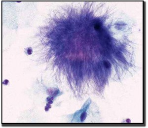 actinomyces-microscope-large-BDR