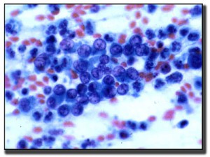endometrial_glandular_cells-BDR