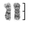 isochromosome Xp