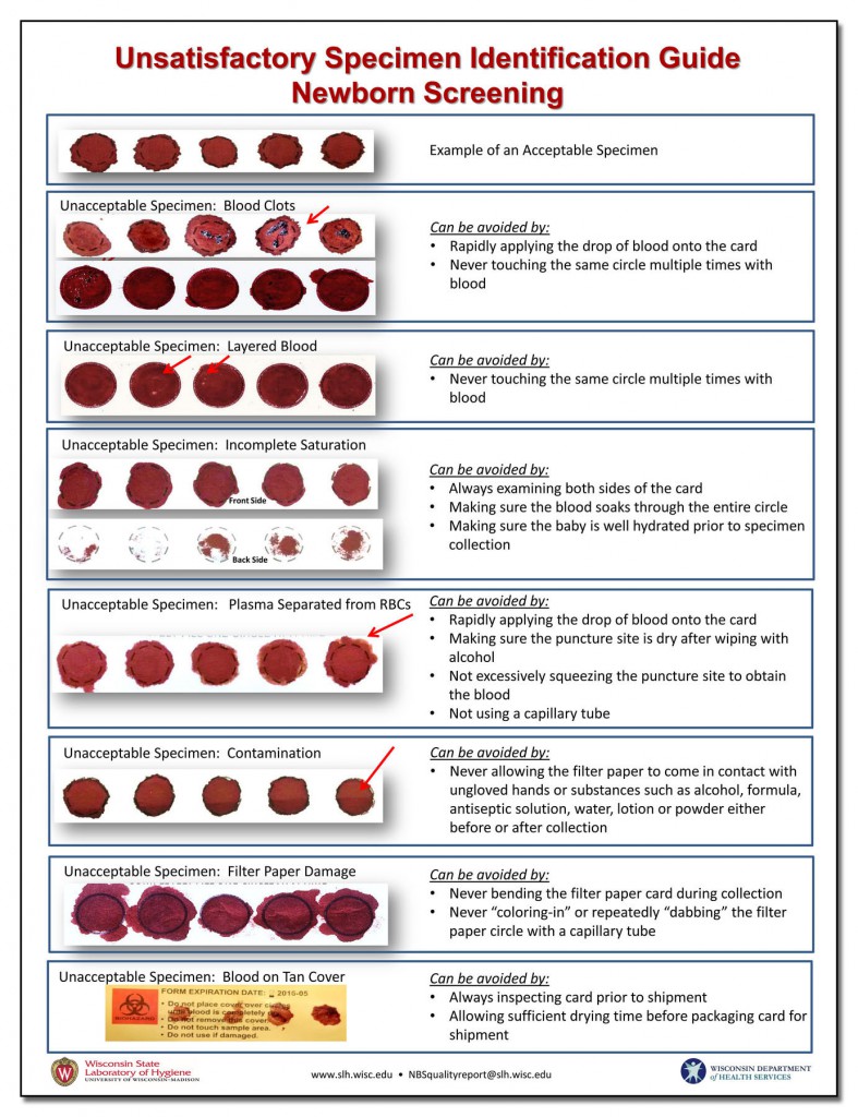 NBSPowerPoint Presentation Wisconsin State Laboratory of Hygiene