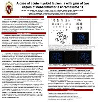 A case of acute myeloid leukemia with gain of two copies of neocentromeric chromosome 11